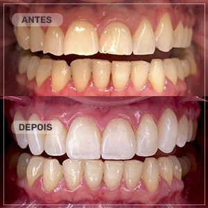 ANTES E DEPOIS foto1